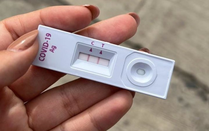 Piden diputados de MC regular precios de pruebas contra COVID-|9 