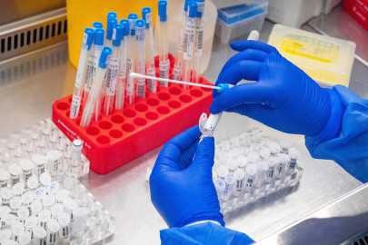 Confirman en Jalisco cinco casos de la viruela del mono 