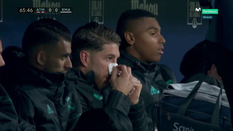 Sergio Ramos tiene fractura de tabique nasal