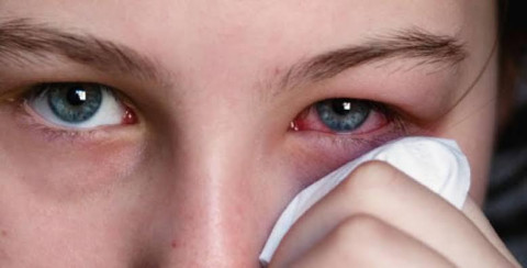 Temen médicos propagación de la conjuntivitis en Matamoros 