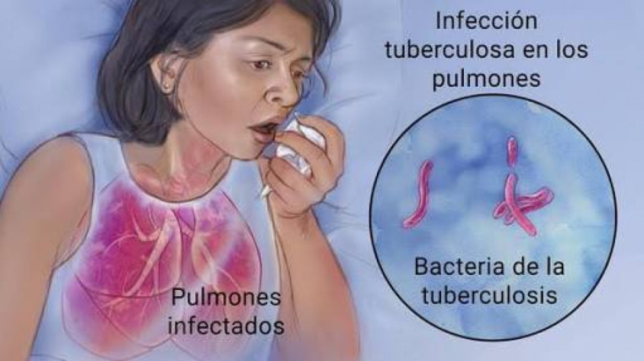 Va Salud contra sarampión y tuberculosis