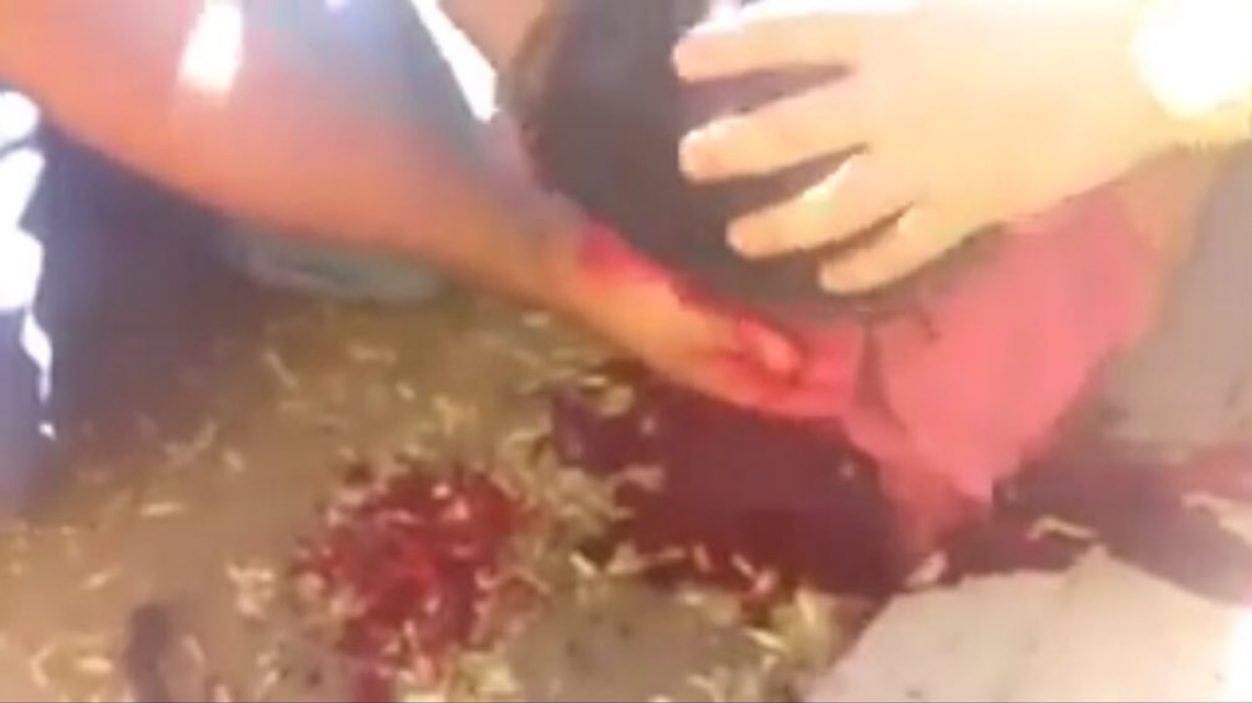 "No fue un disparo como tal", dice Aureoles sobre normalista herido