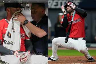 David Fry sufre fracturas faciales tras brutal pelotazo en la MLB