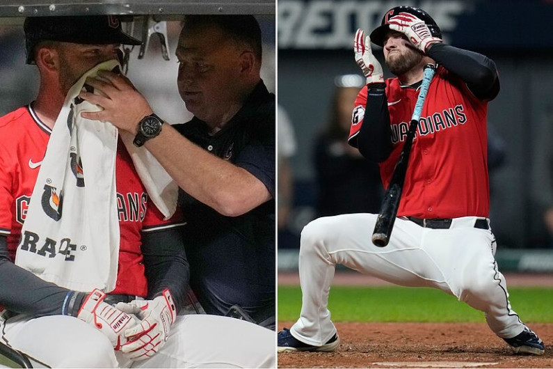 David Fry sufre fracturas faciales tras brutal pelotazo en la MLB