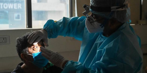 Confirman cuatro casos de Hongo Negro en Sinaloa