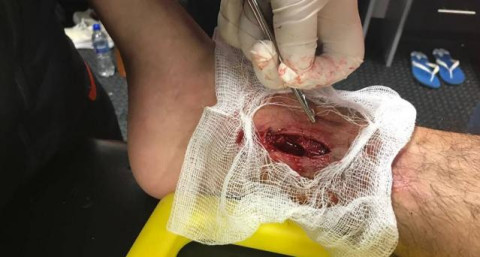 Hirving Lozano sufre una lesión durante partido 