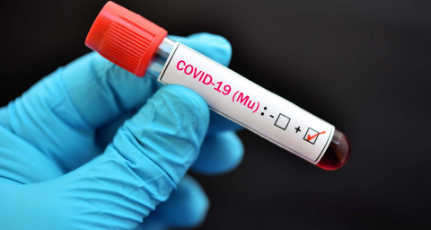 Detectan 379 casos de variante Mu en 26 estados