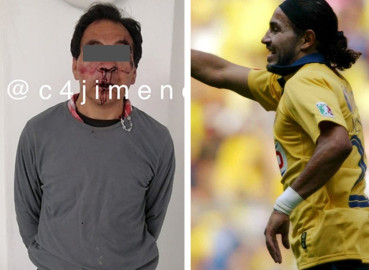 Madre de exjugador del América fue atacada con un cuchillo 