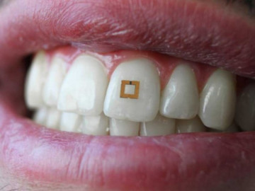 Desarrollan dispositivo que identificará calorías