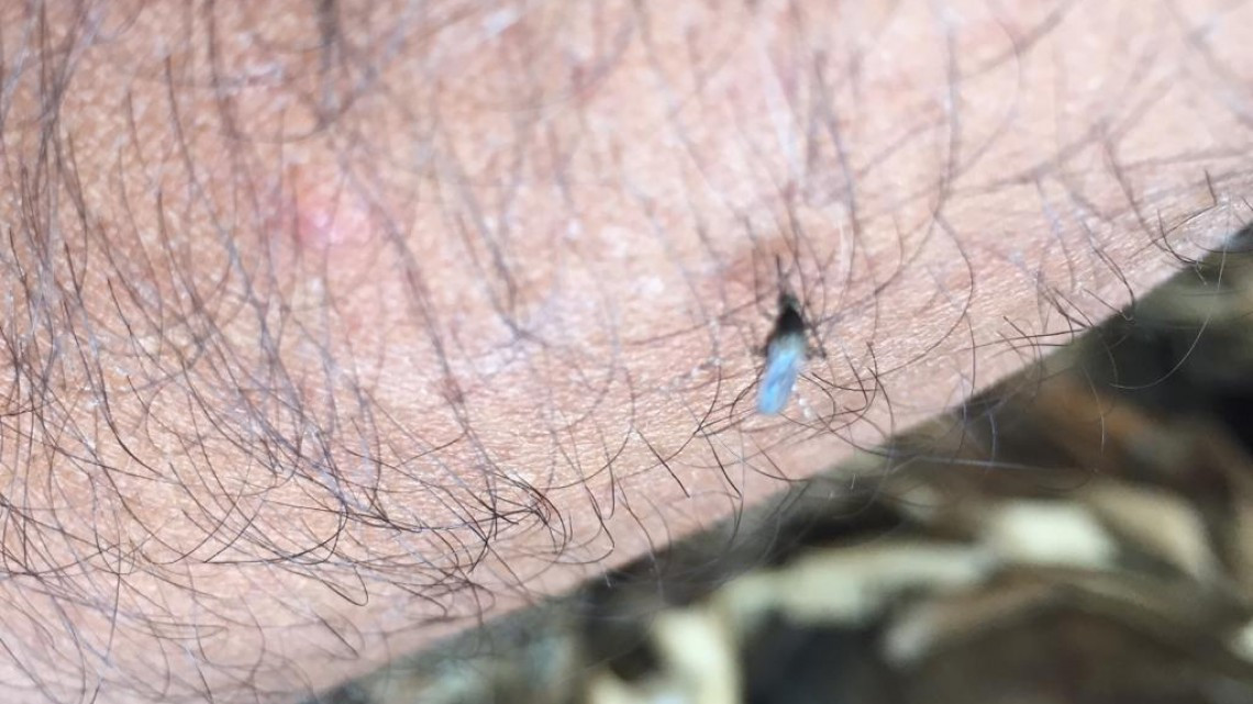 Retoman acciones de lucha contra el mosco transmisor del dengue