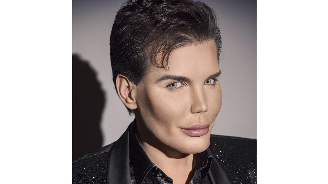 El "Ken humano" tiene complicaciones para respirar