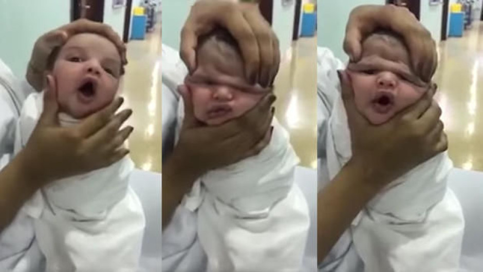 Despiden enfermeras por "divertirse" con la cara de un bebé