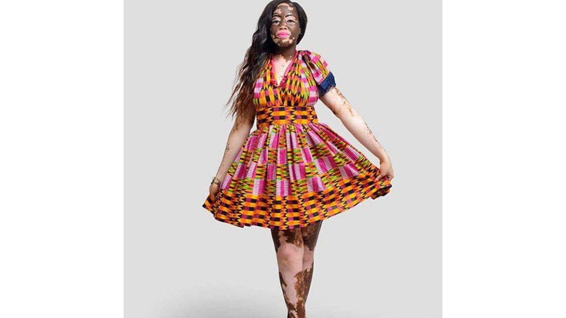 Honya Enam, una modelo que supero los estereotipos