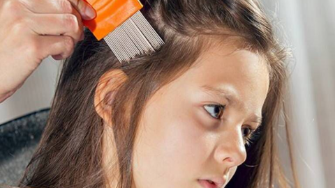 Llama IMSS en Nuevo Laredo a prevenir la pediculosis en menores durante la pandemia 