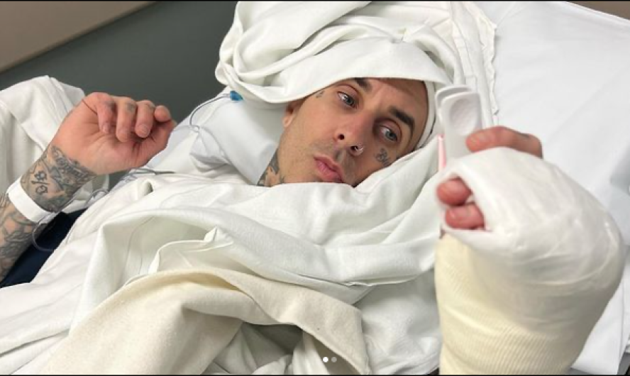 Travis Barker comparte foto de su operación del dedo
