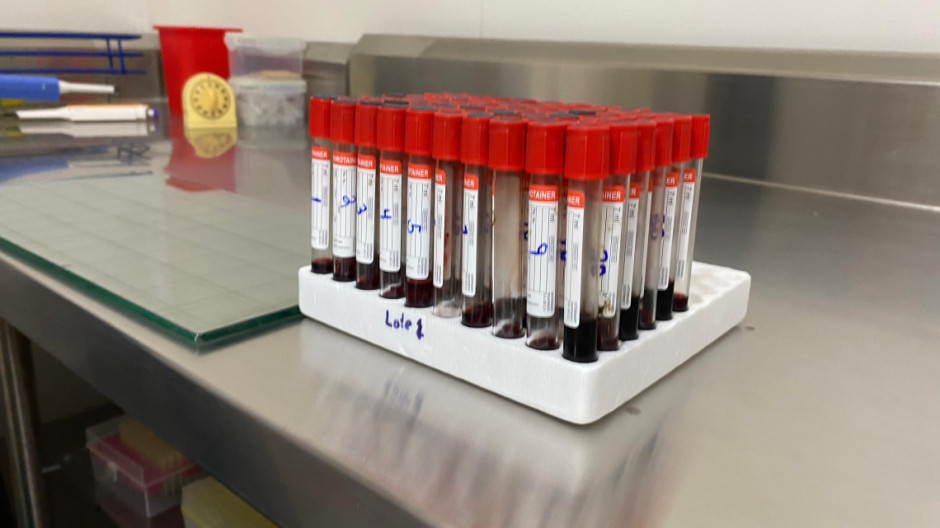 Realizan más de 8 mil pruebas de brucelosis en ganado