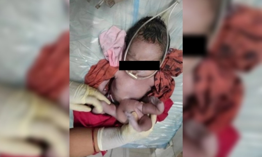 Bebé de 4 brazos es aclamado como reencarnación divina 