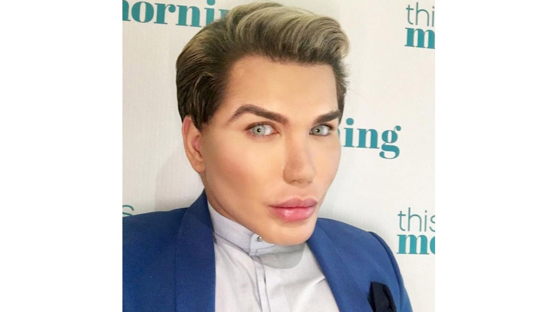 El "Ken humano" tiene complicaciones para respirar