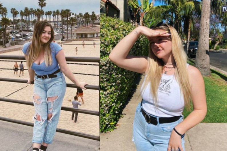 Se opera para reducir sus senos; le vuelven a crecer