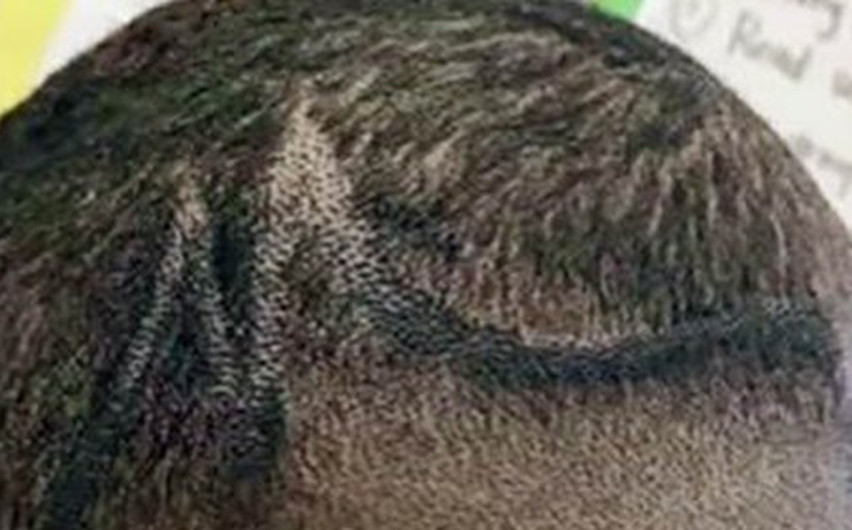  Empleados de una escuela en Texas pintan con marcador la cabeza de un niño 