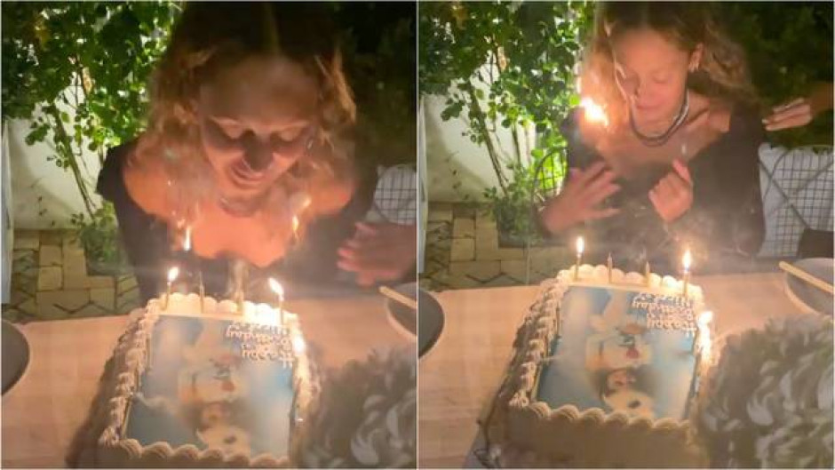 Tragedia nivel: incendia su cabello al soplar vela de cumpleaños